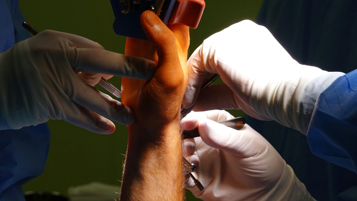 Лучшие специалисты по хирургии кисти в Индии