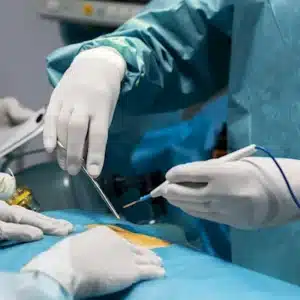 Get a liver transplant in India