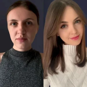 Пластика носа в Стамбуле Safak Aktar