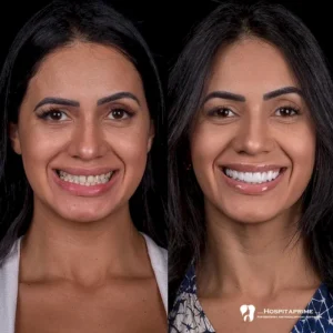 Цифровой дизайн в Турции Eren Pera