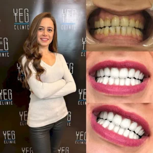 DSD в Турции Omer Oner