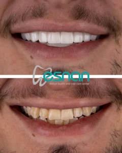 DSD в Турции Caner Cakli