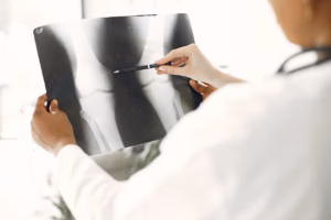 Best hospitals and doctors for bone cancer treatment in Turkey