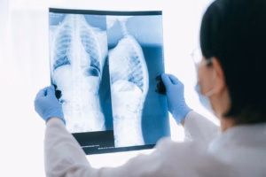 Best hospitals and doctors for lung cancer treatment in Turkey